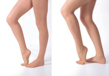 膝の裏をのばすとキレイ（左）、膝の裏が伸びていないとおしりがさがってしまいます（右）

